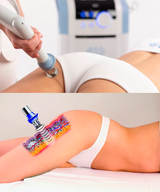 Radical Off Celulitis