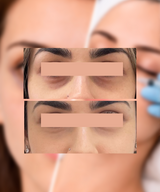 Pack Adiós Ojeras